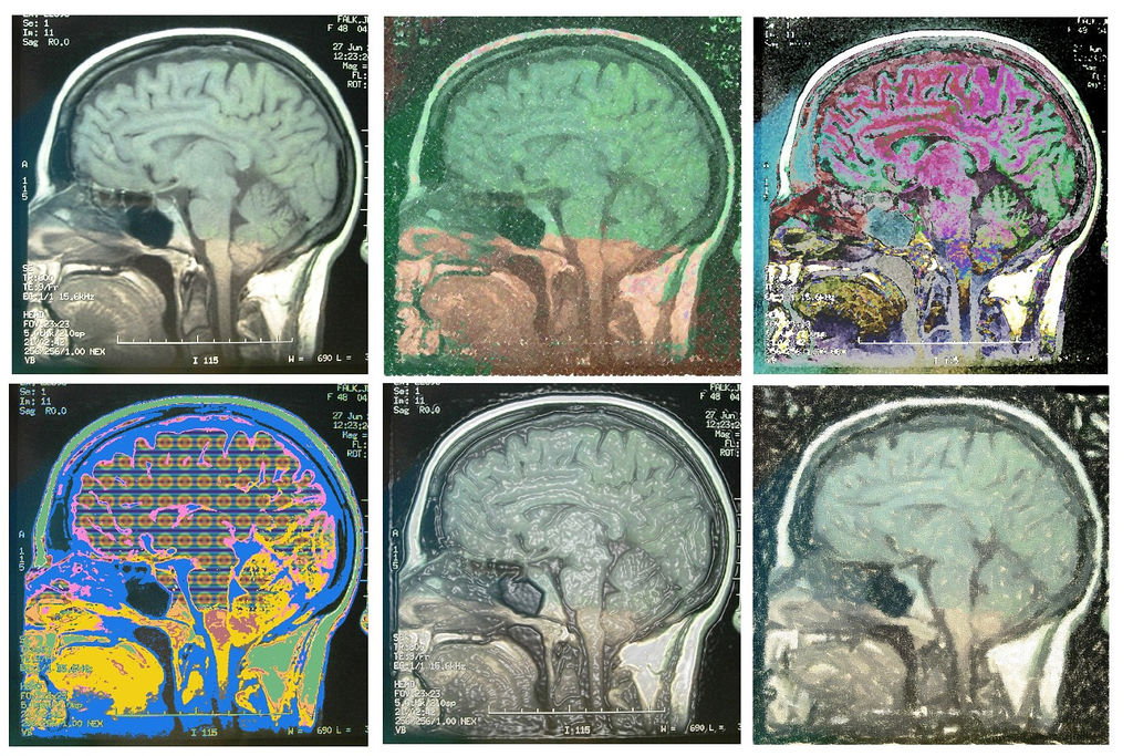 hand colored MRI brain scan images