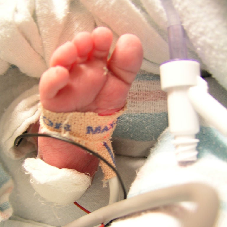 baby's foot with pulse oximeter