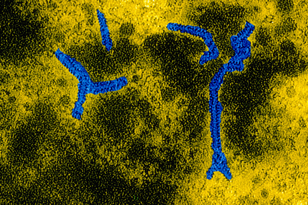 Mumps virus (paramyxovirus)  Electron microscope image of the virus responsible from mumps (paramyxovirus)