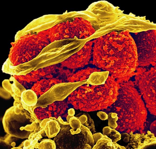 Scanning electron micrograph of methicillin-resistant Staphylococcus aureus bacteria (MRSA)