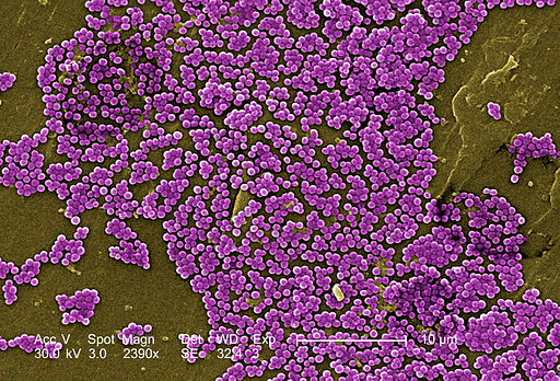 Methicillin resistant Staphylococcus aureus, Centers for Disease Control and Prevention