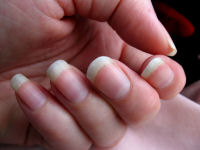 Finger nails