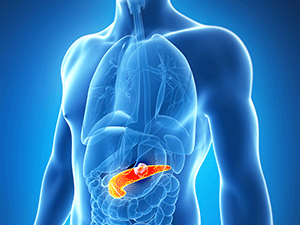 pancreatic cancer illustration