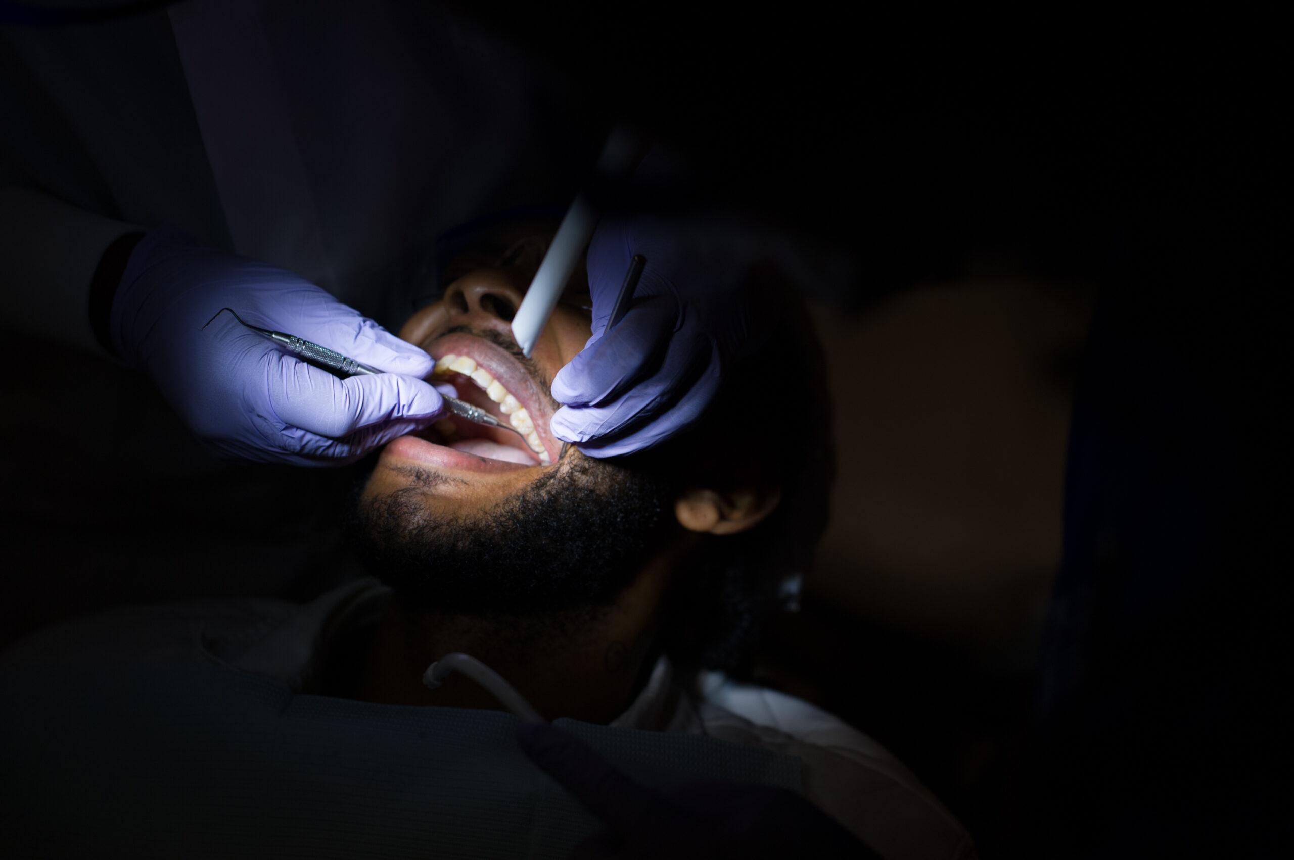 Dentist working on a filling for a patient