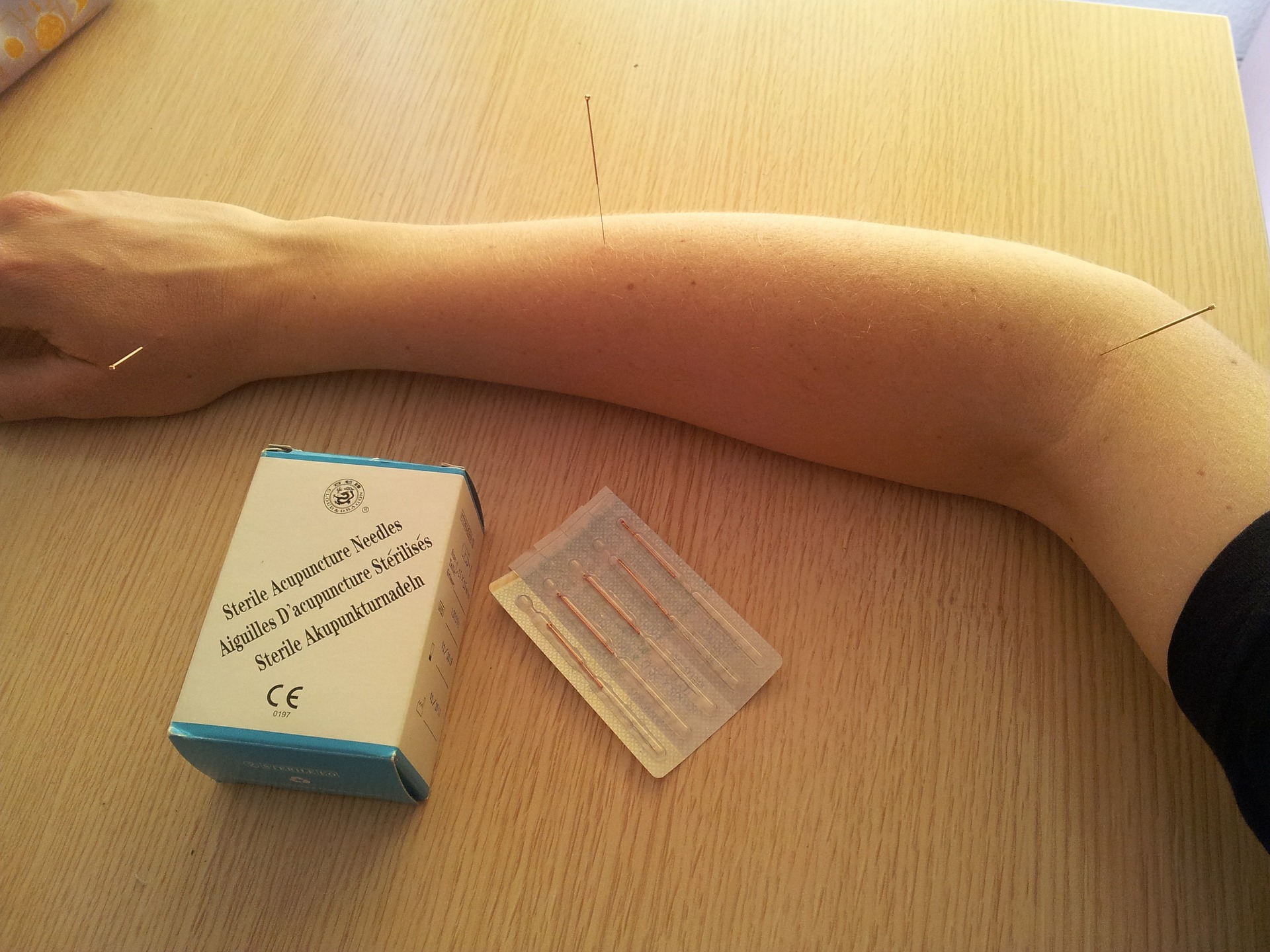 Acupunture needled in arm