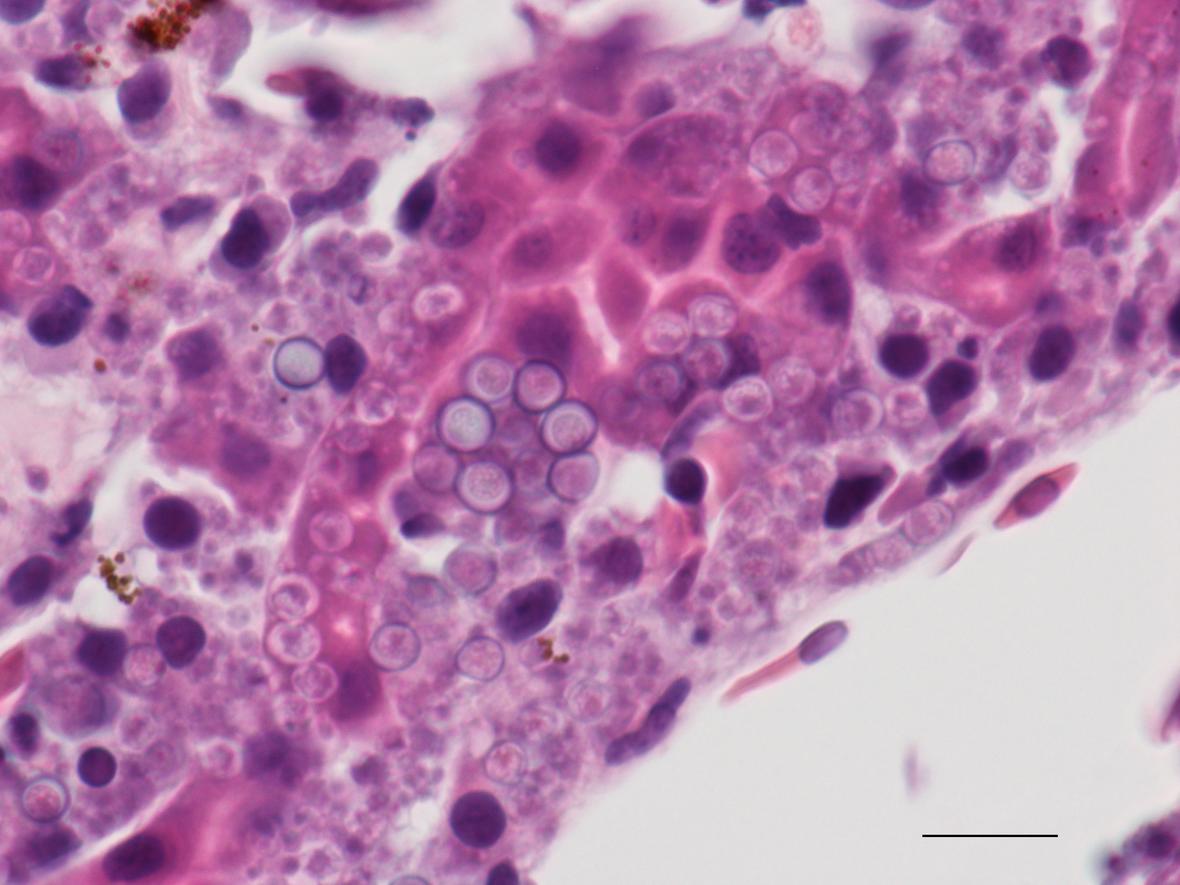 frog liver with severe Perkinsea infection