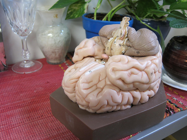 Brain model.