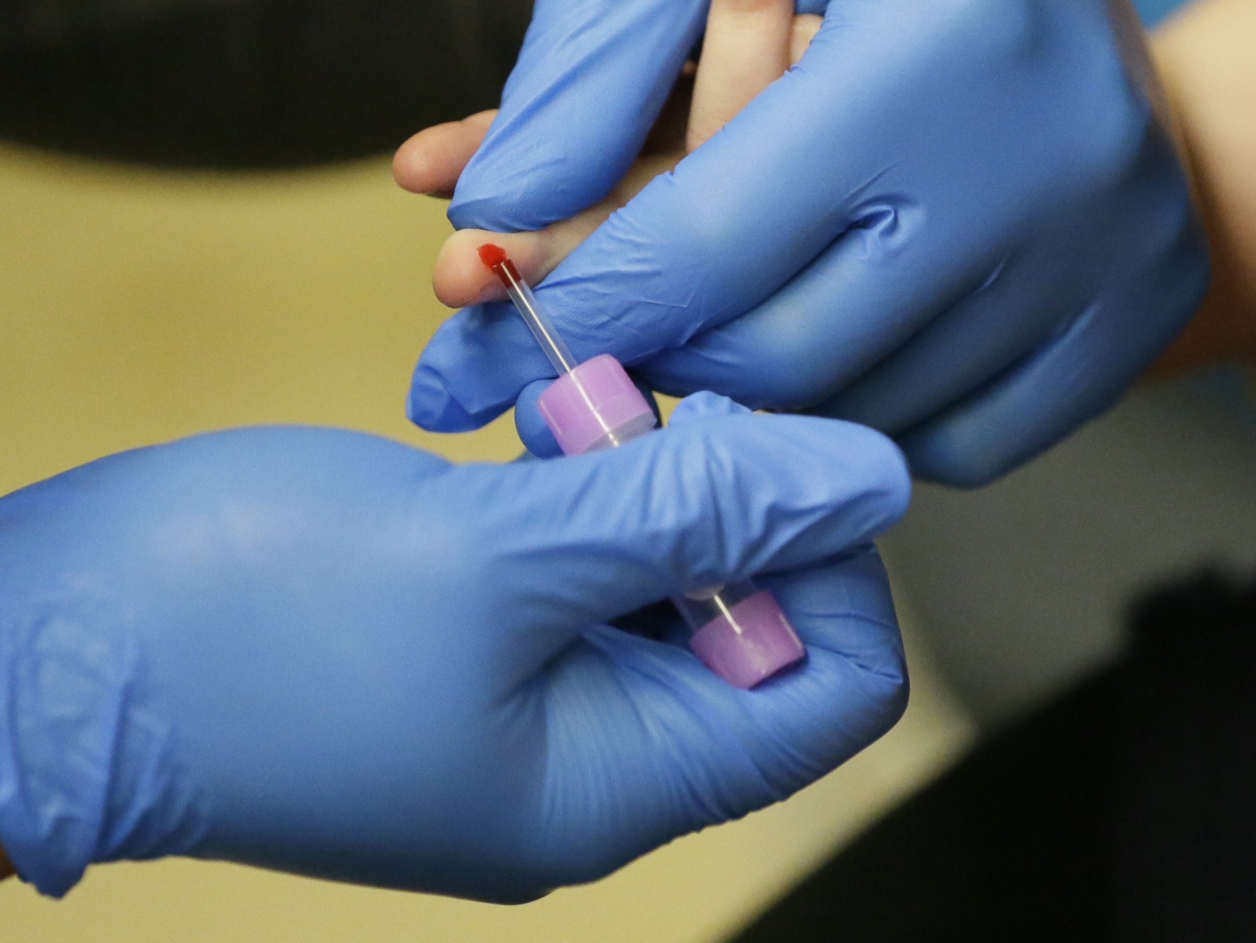 Finger prick blood test for lead