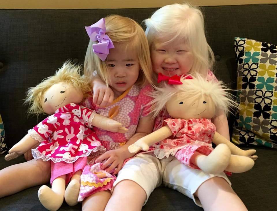 dolls, toys, albinism, Asian American, girls, sisters