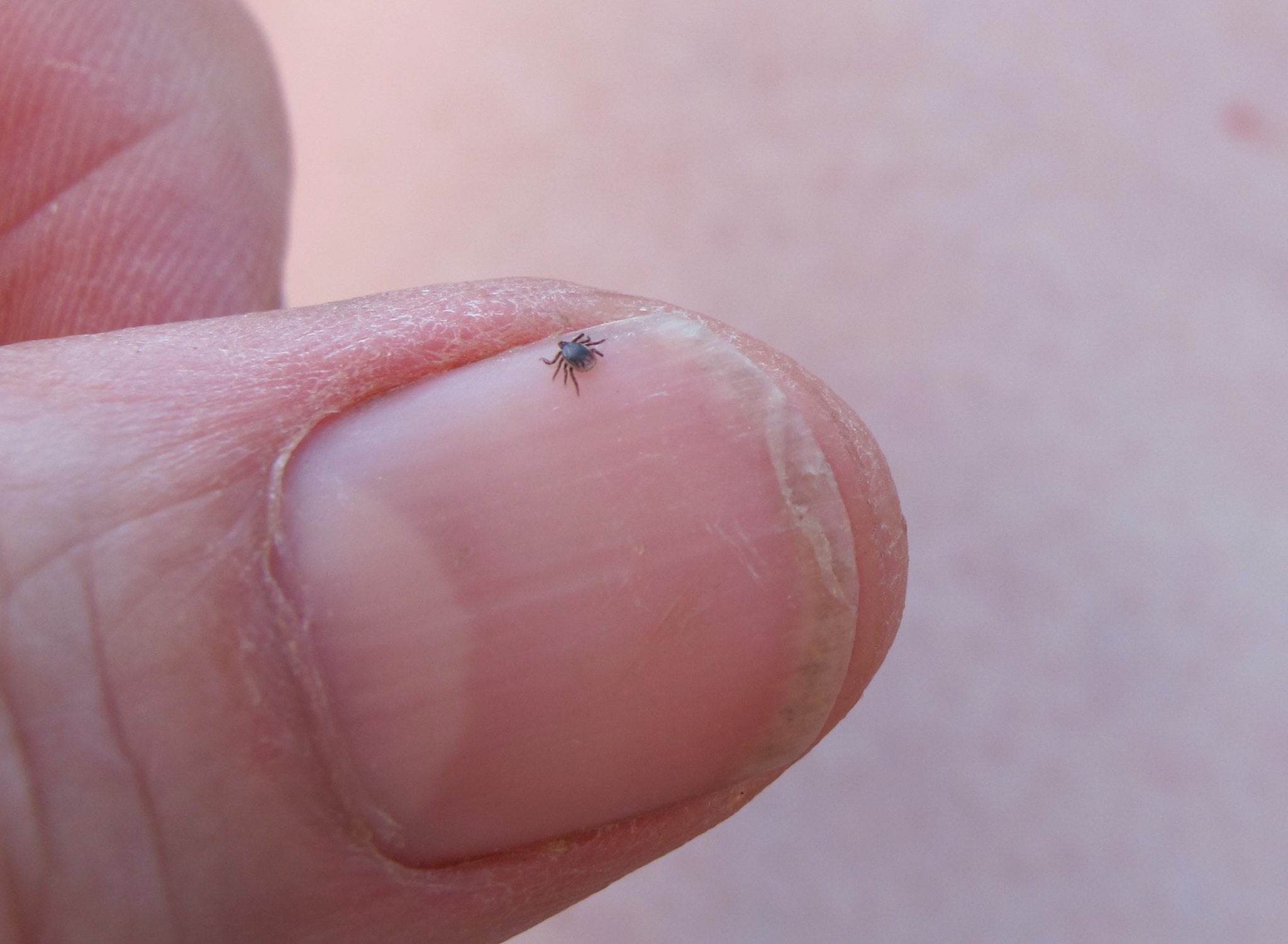 deer tick on thumbnail