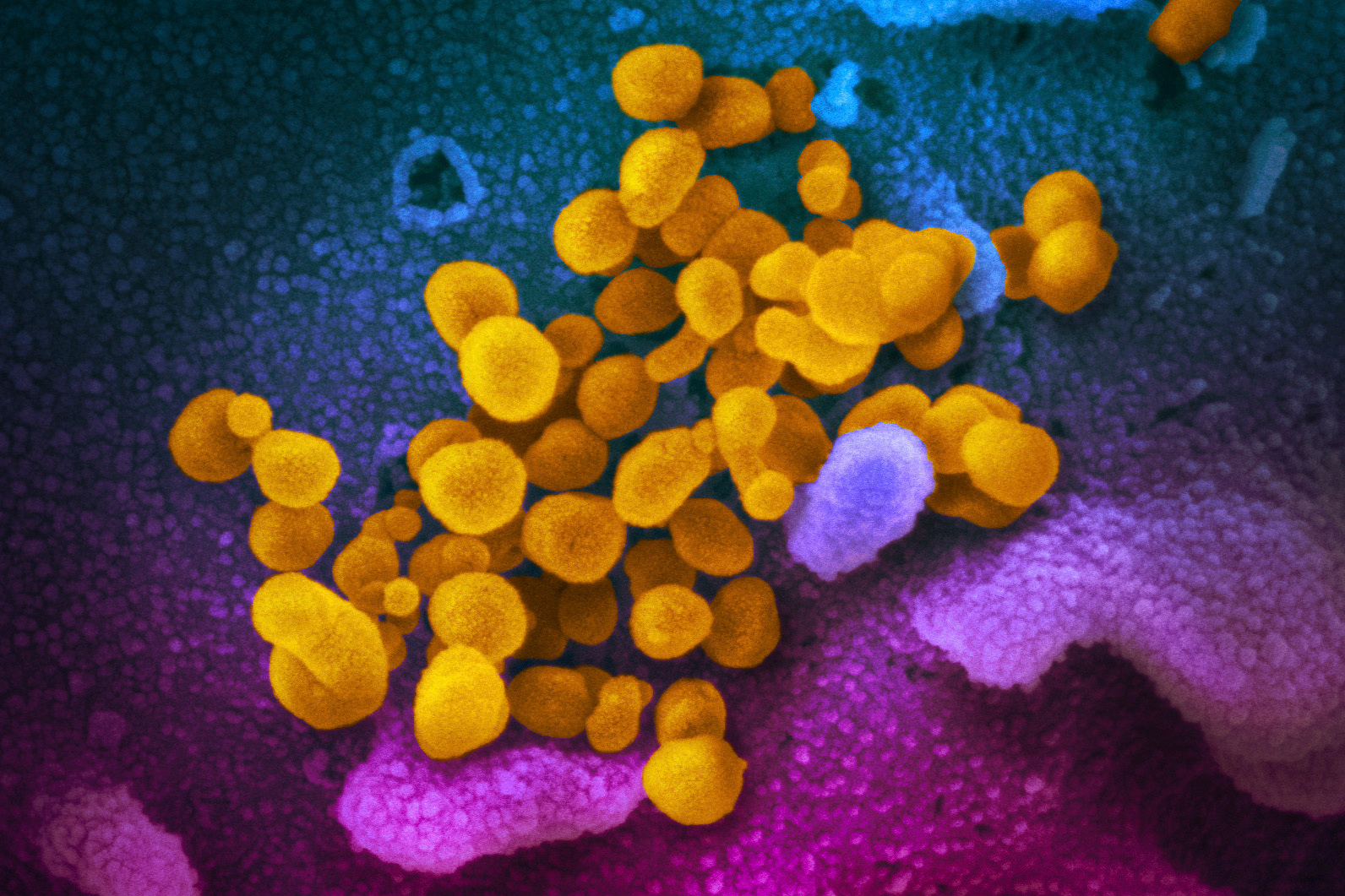 Microscopic image of coronavirus