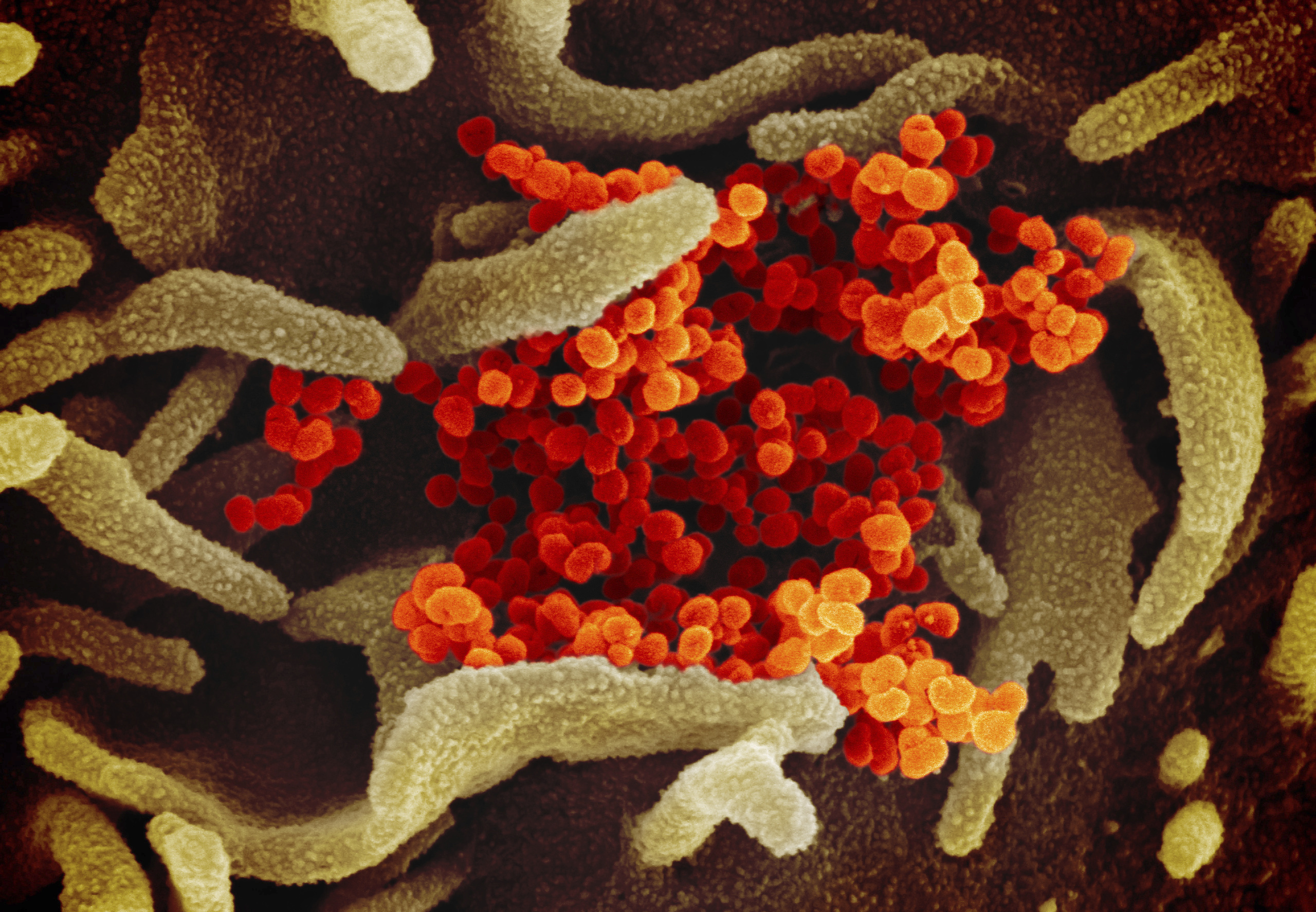 An electron microscope image of 2019-nCoV, the virus that causes COVID-19.