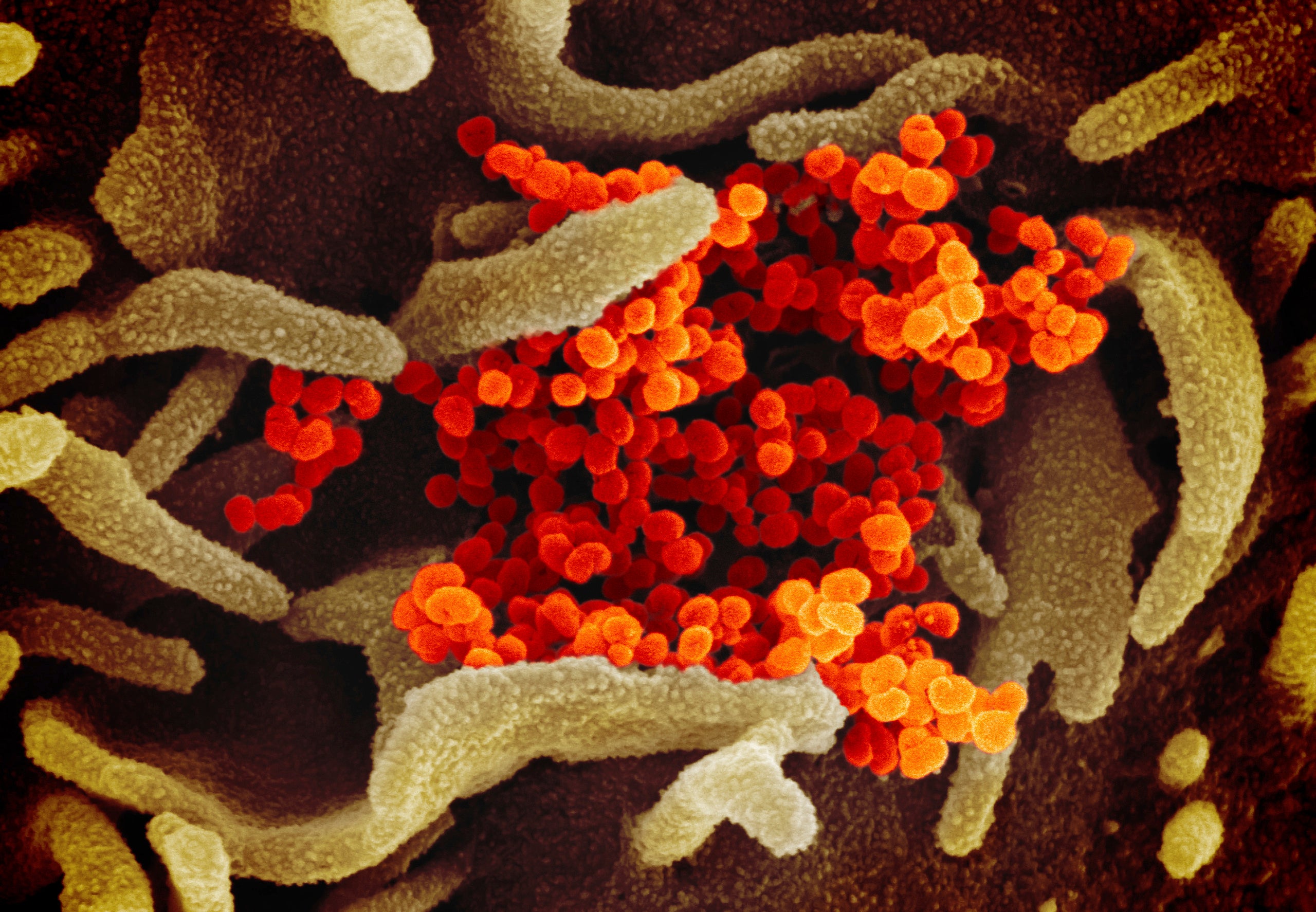 An electron microscope image of 2019-nCoV, the virus that causes COVID-19.