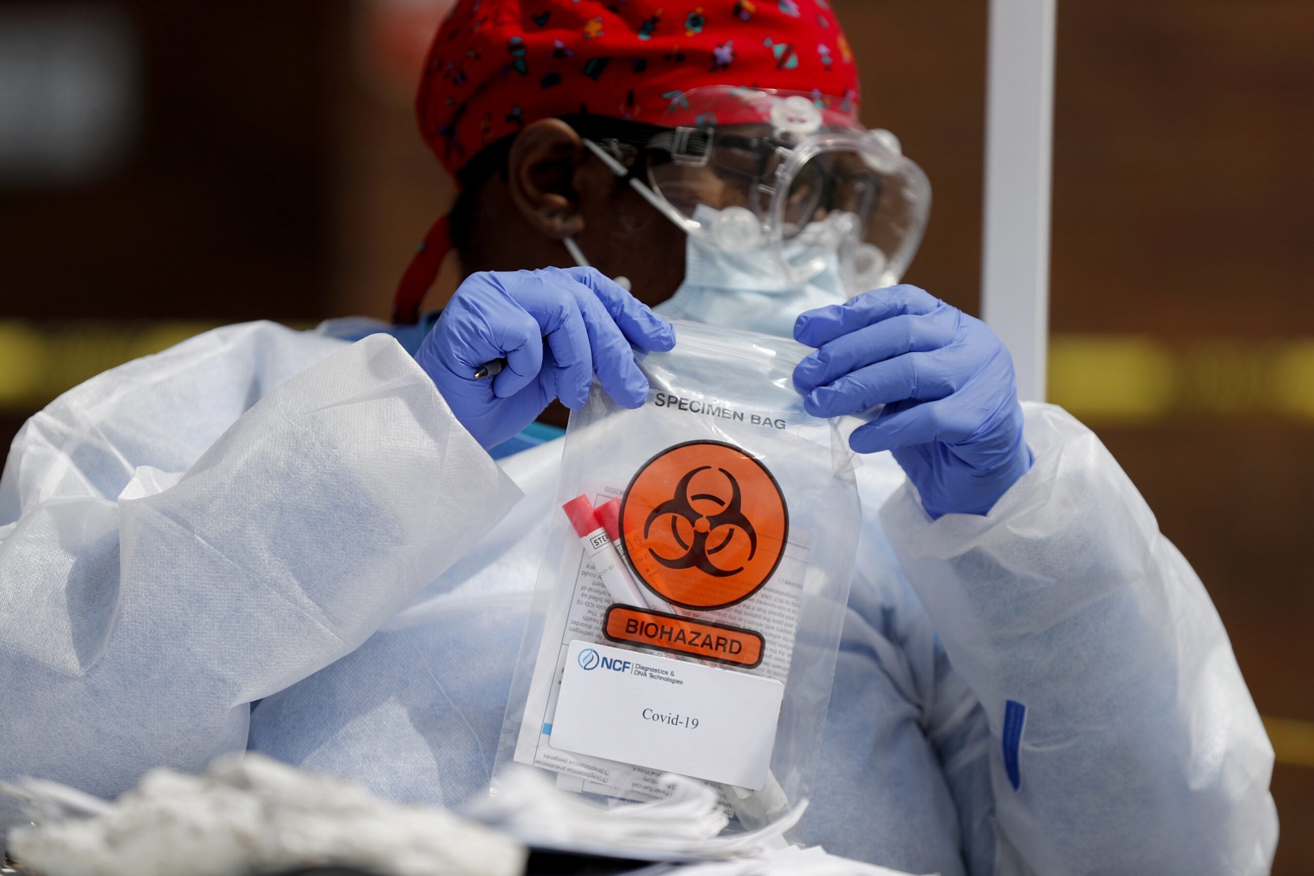 Registered medical assistant Elaine Lomax handles a nasal swab specimen for COVID-19