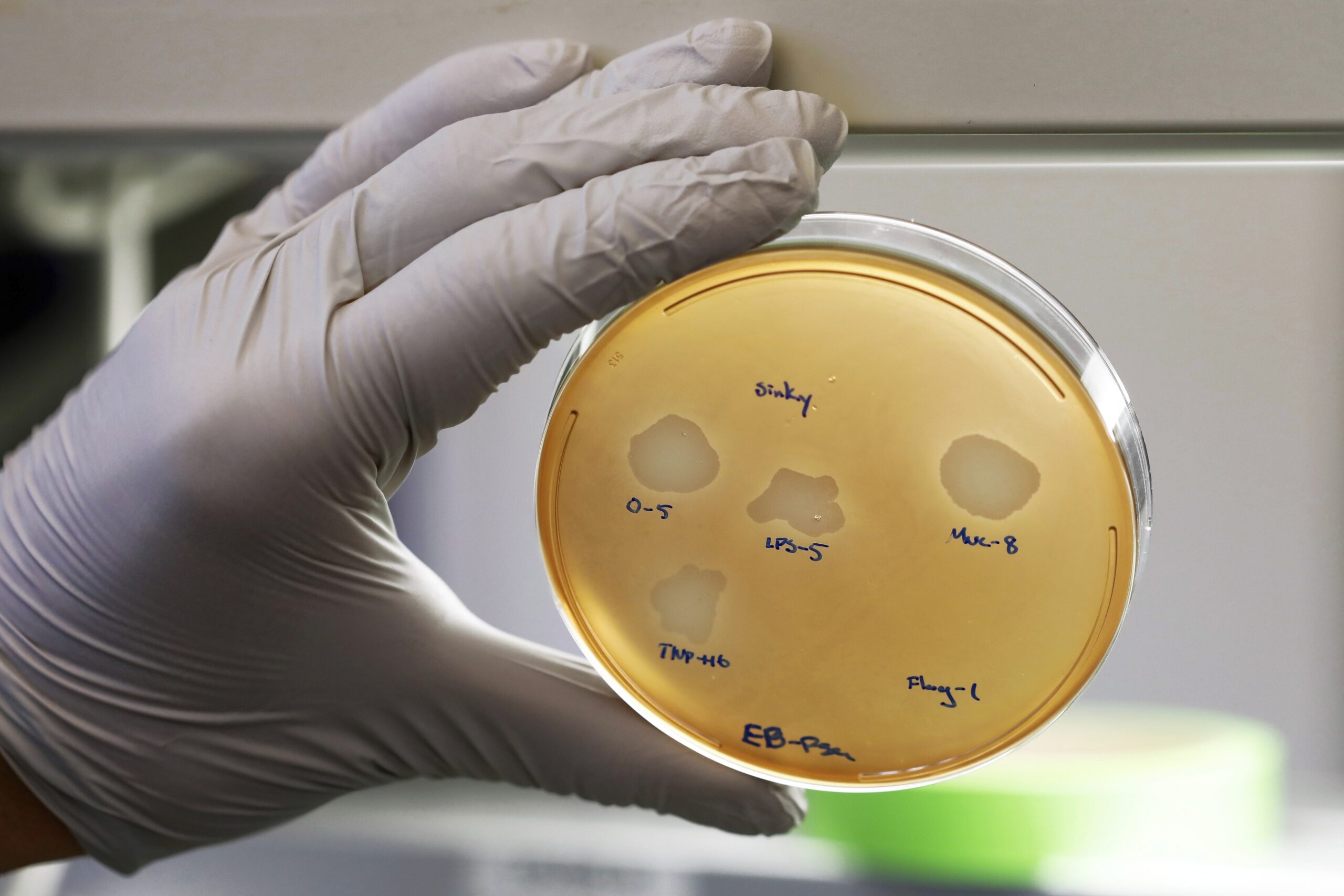 MRSA, antibiotic-resistant bacteria, germs, epidemic