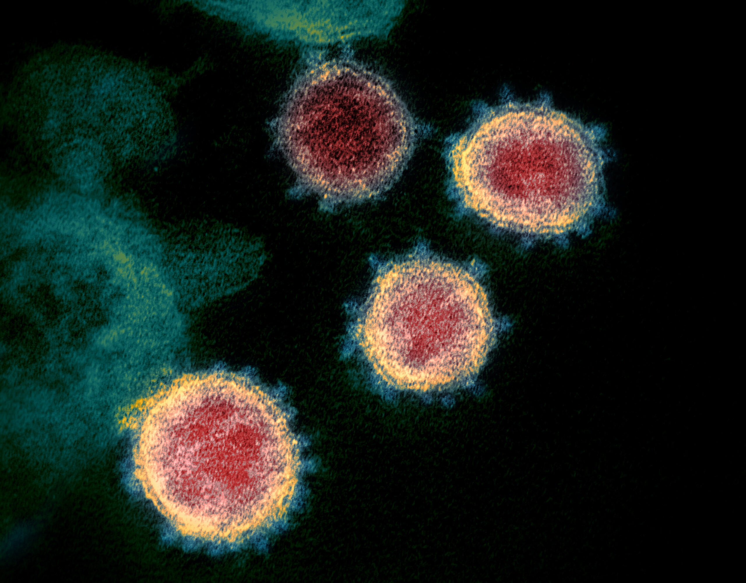 Four pink circles -- the novel coronavirus -- rest on a blue-green background in this microscope image.