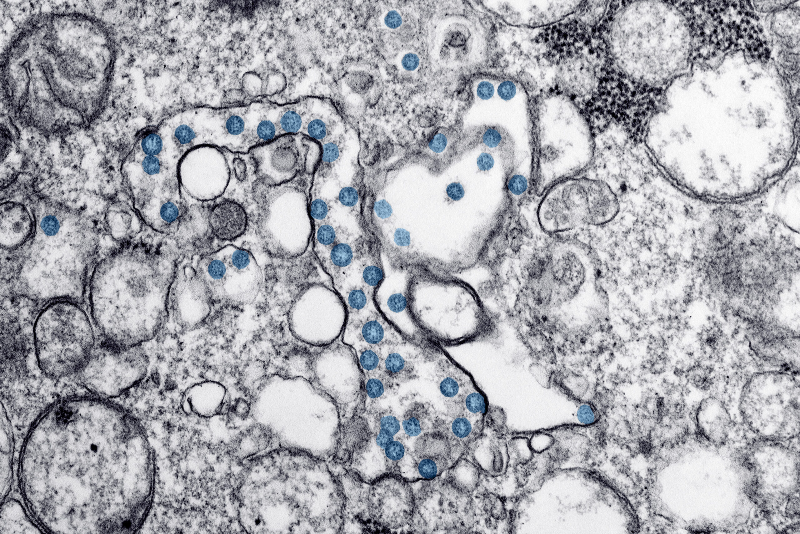 A microscopic image of the coronavirus