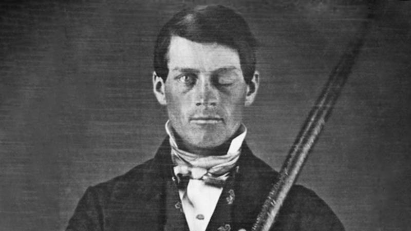 How Phineas Gage’s Freak Accident Changed Brain Science