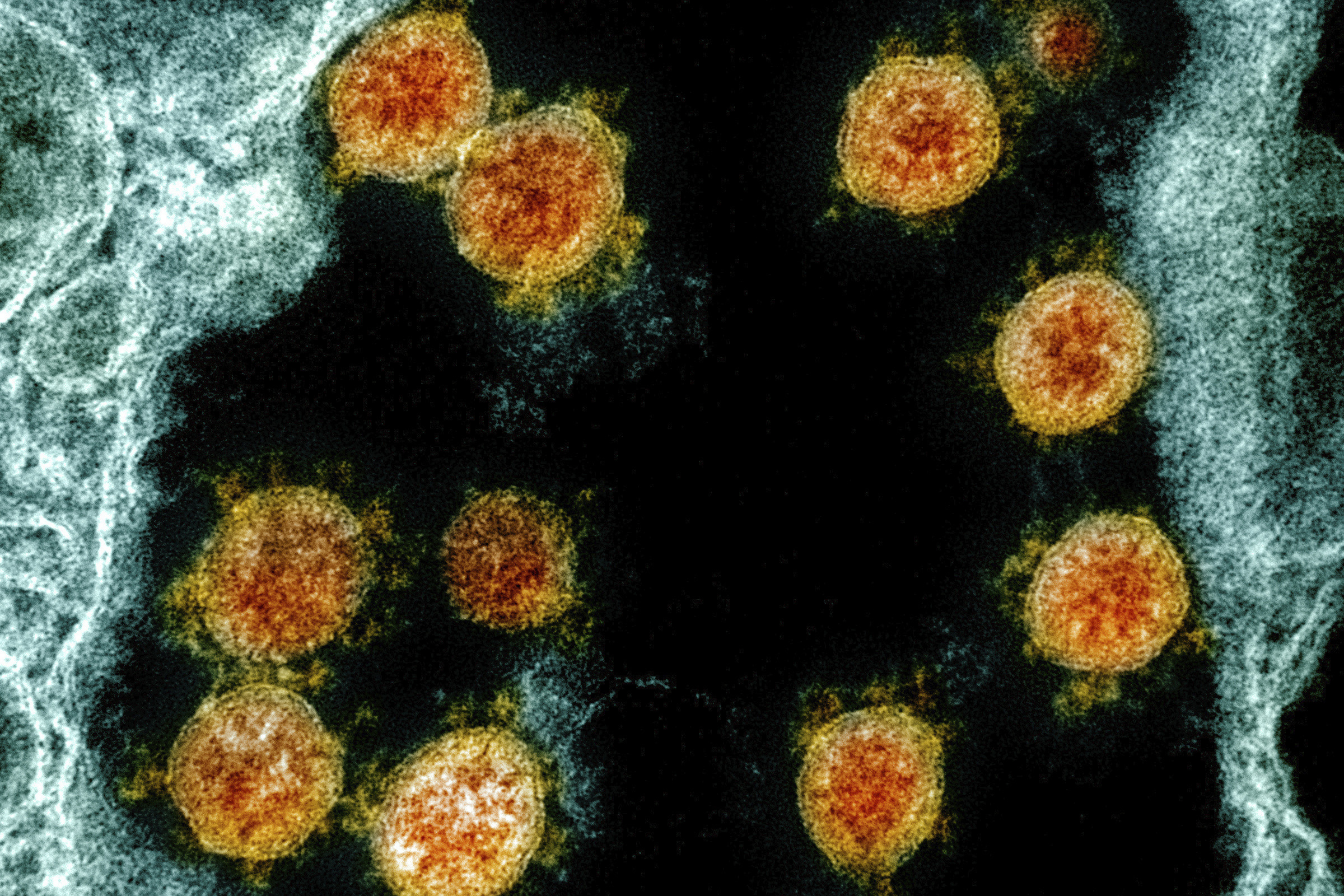 Novel Coronavirus SARS-CoV-2 virus particles