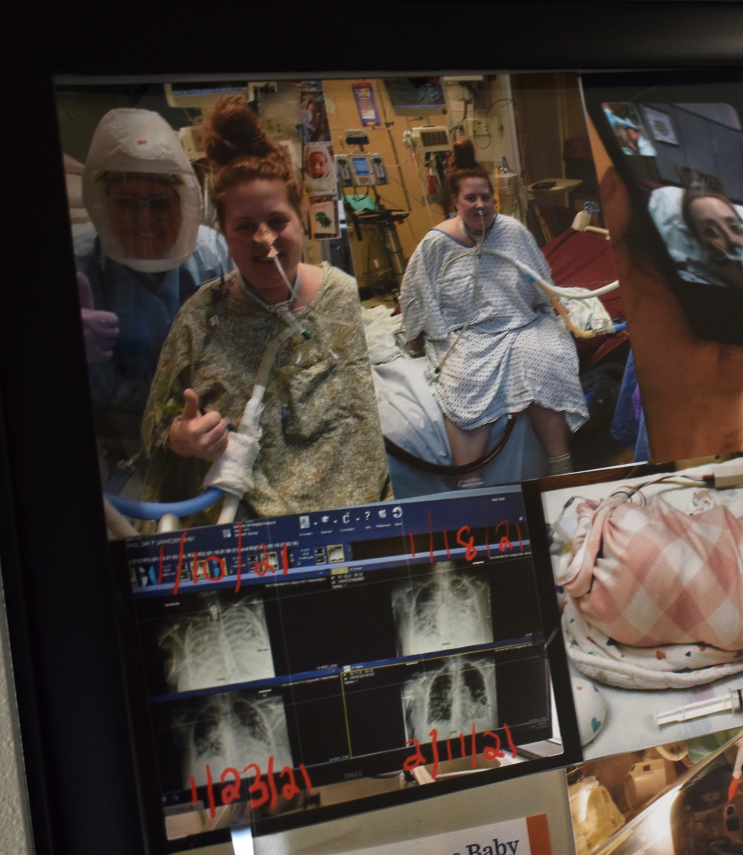 A photo collage on display at a community benefit for the Bloch family displays photos of Betsy Bloch during her time in the hospital, as well as scans taken of her lungs.