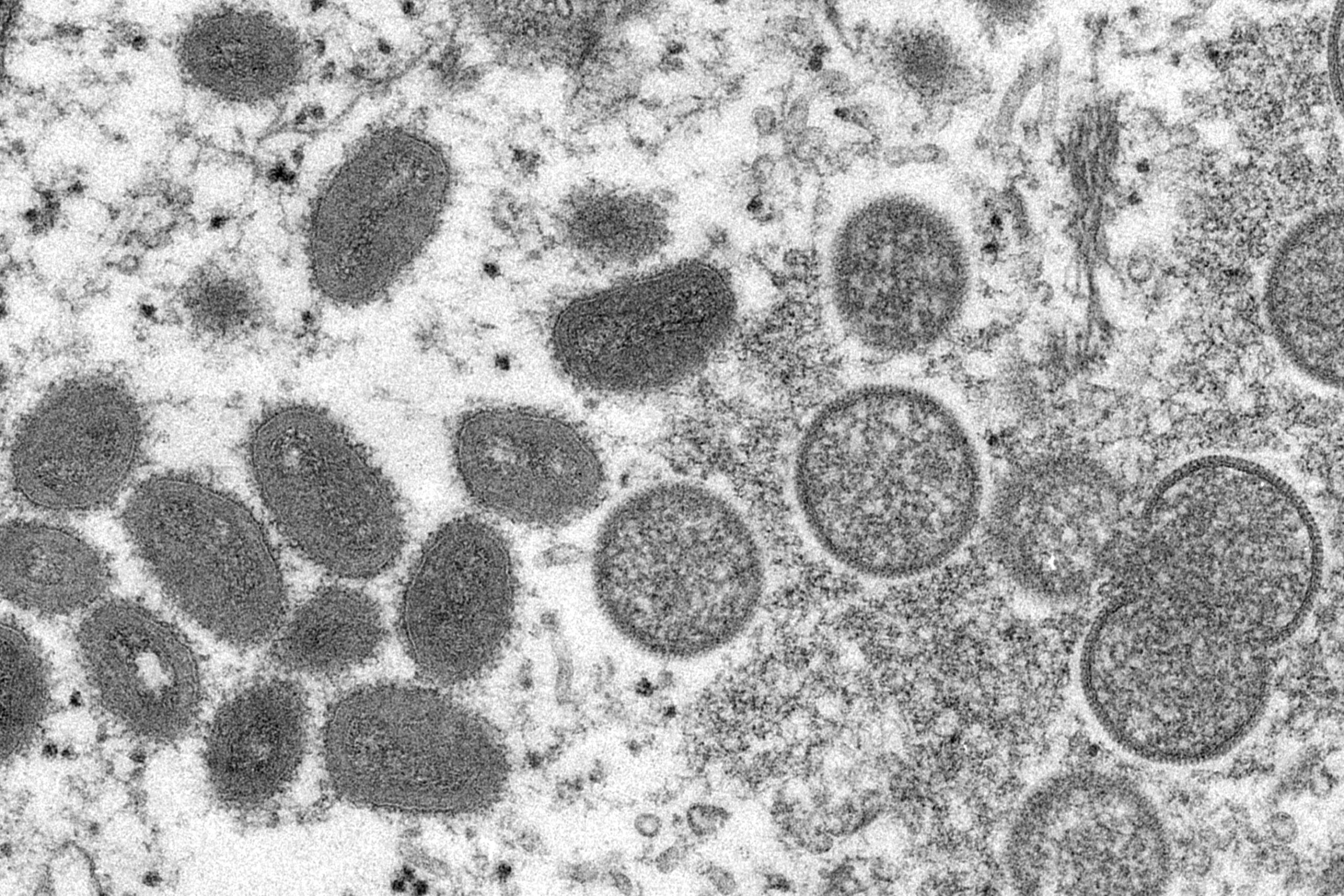 electron microscope image of monkeypox virions.