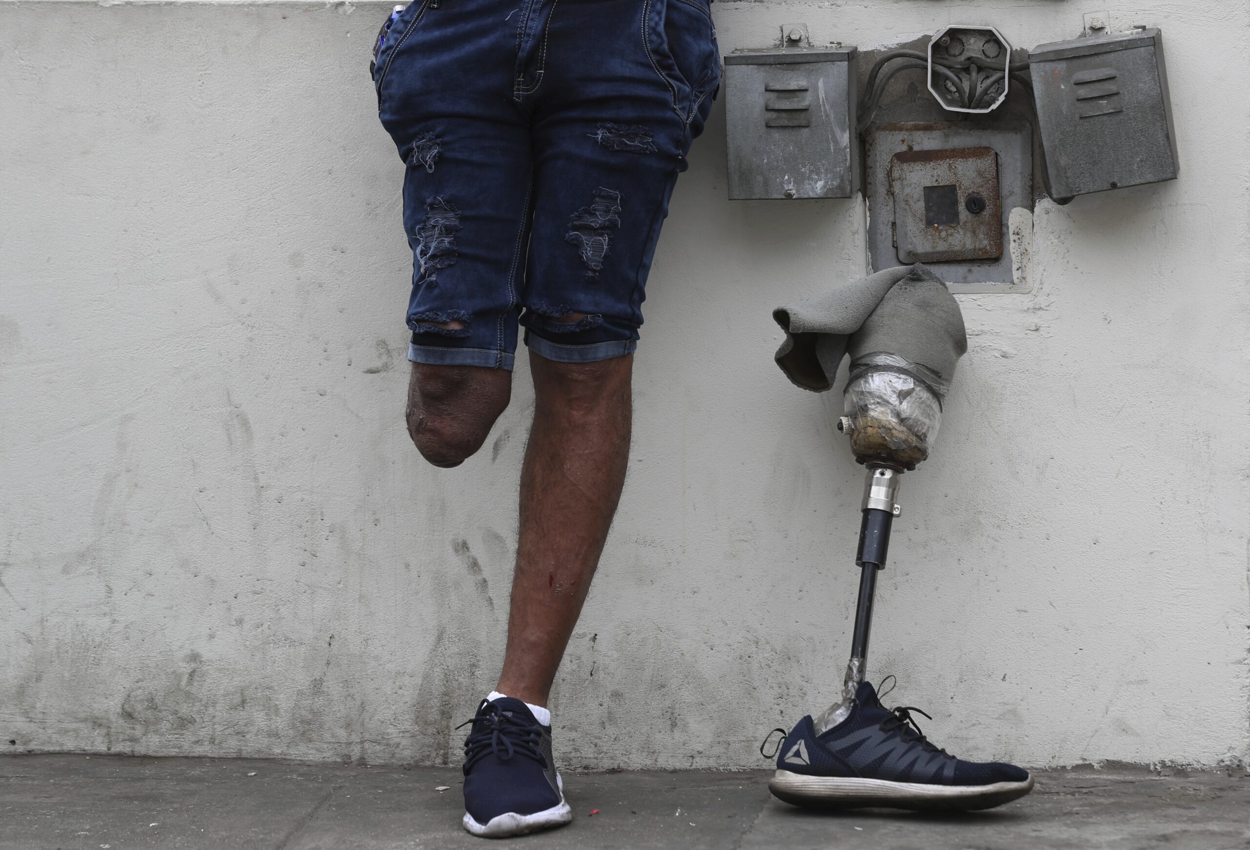 A man with an amputated leg