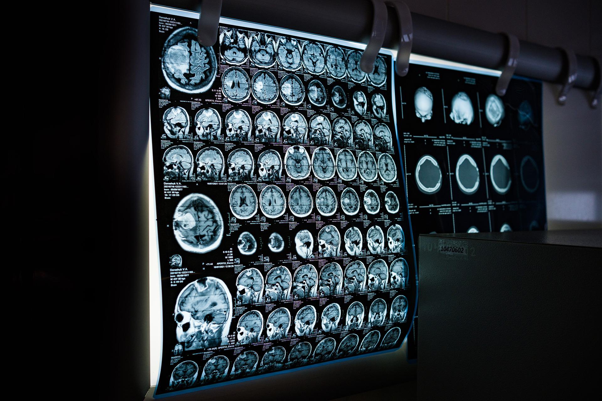 CT scan images.