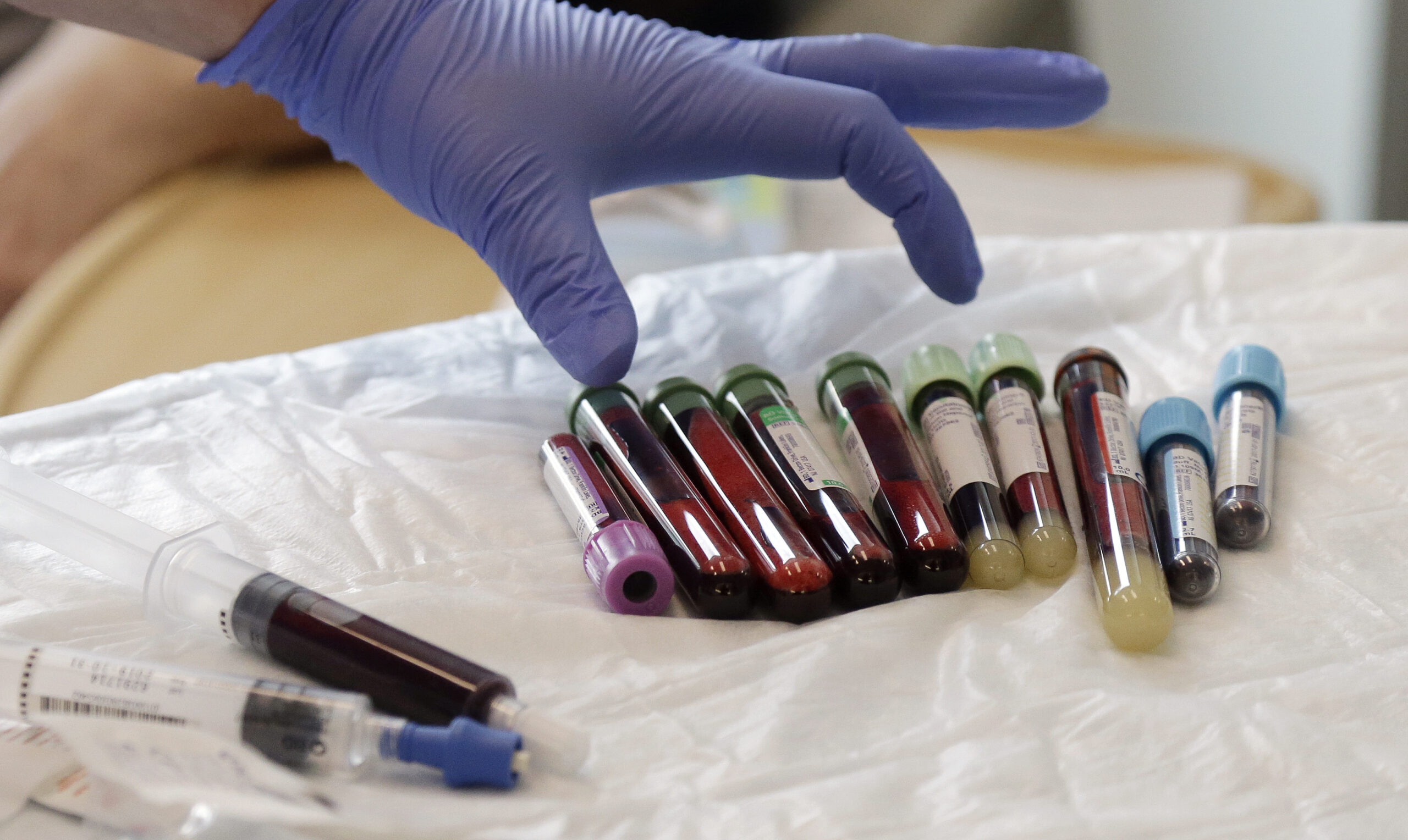 Test tubes of blood with different colored lids lay on a white sheet