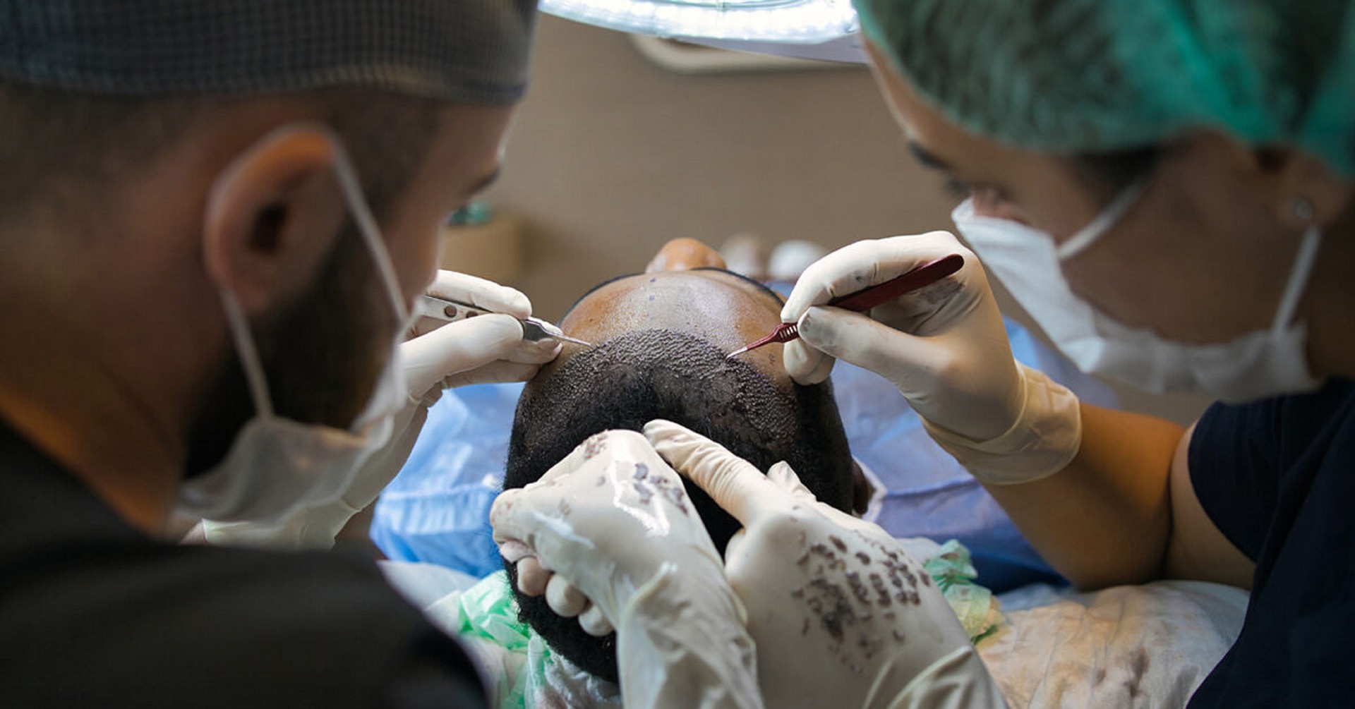 Medical professionals doing a hair transplant.