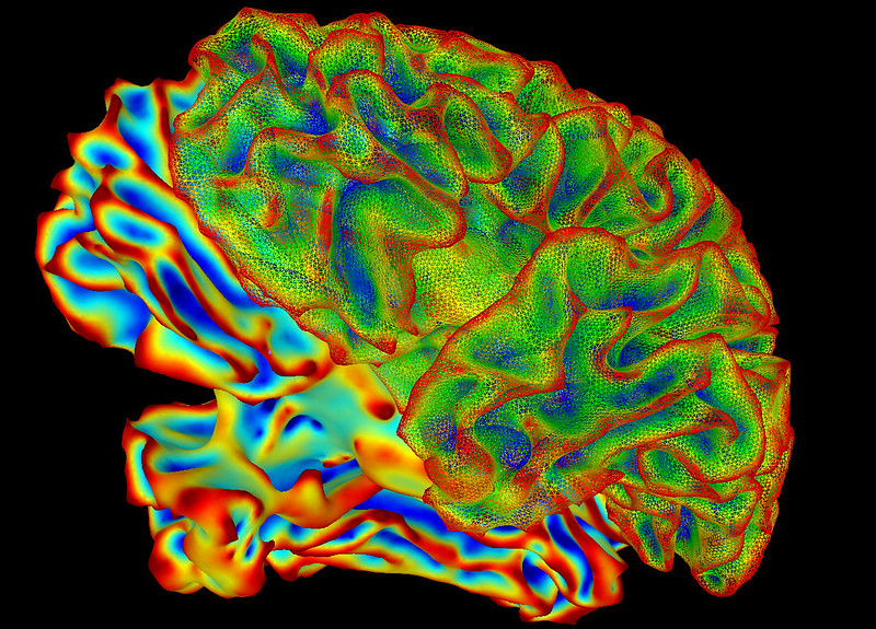 A colorful image of a human brain against a black background