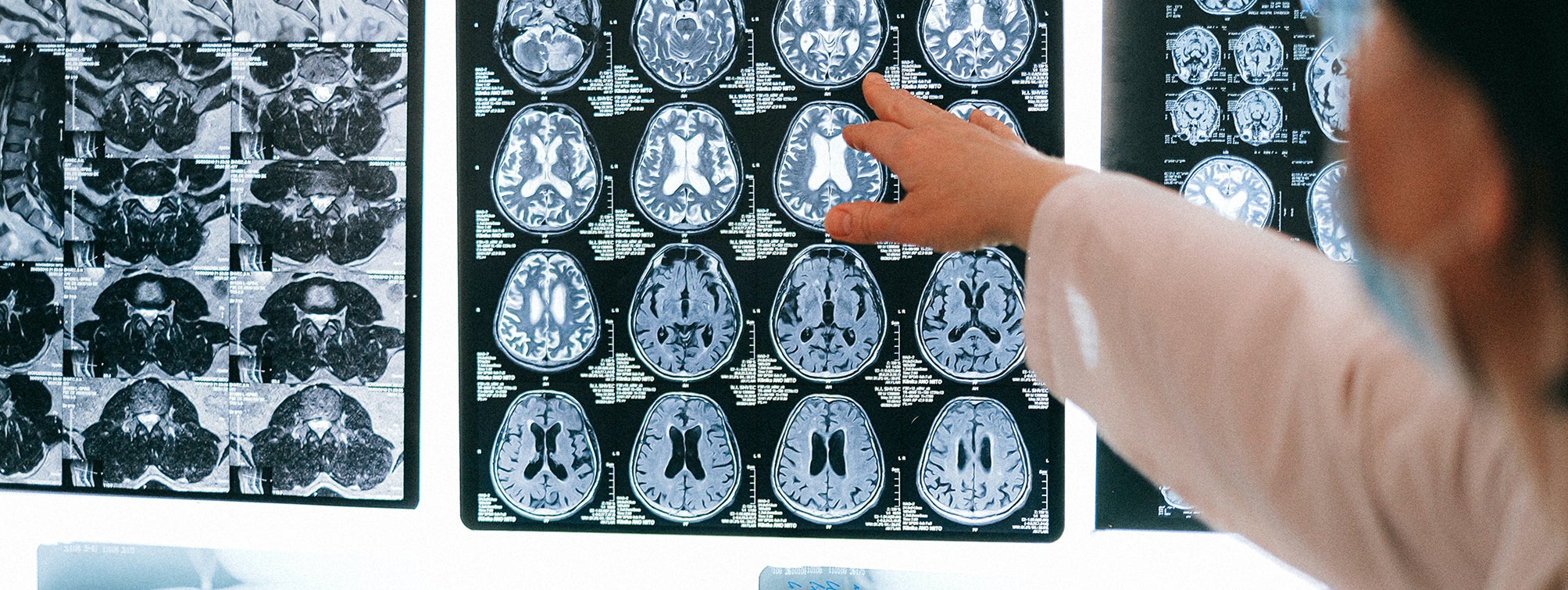 UW Carbone Cancer Center