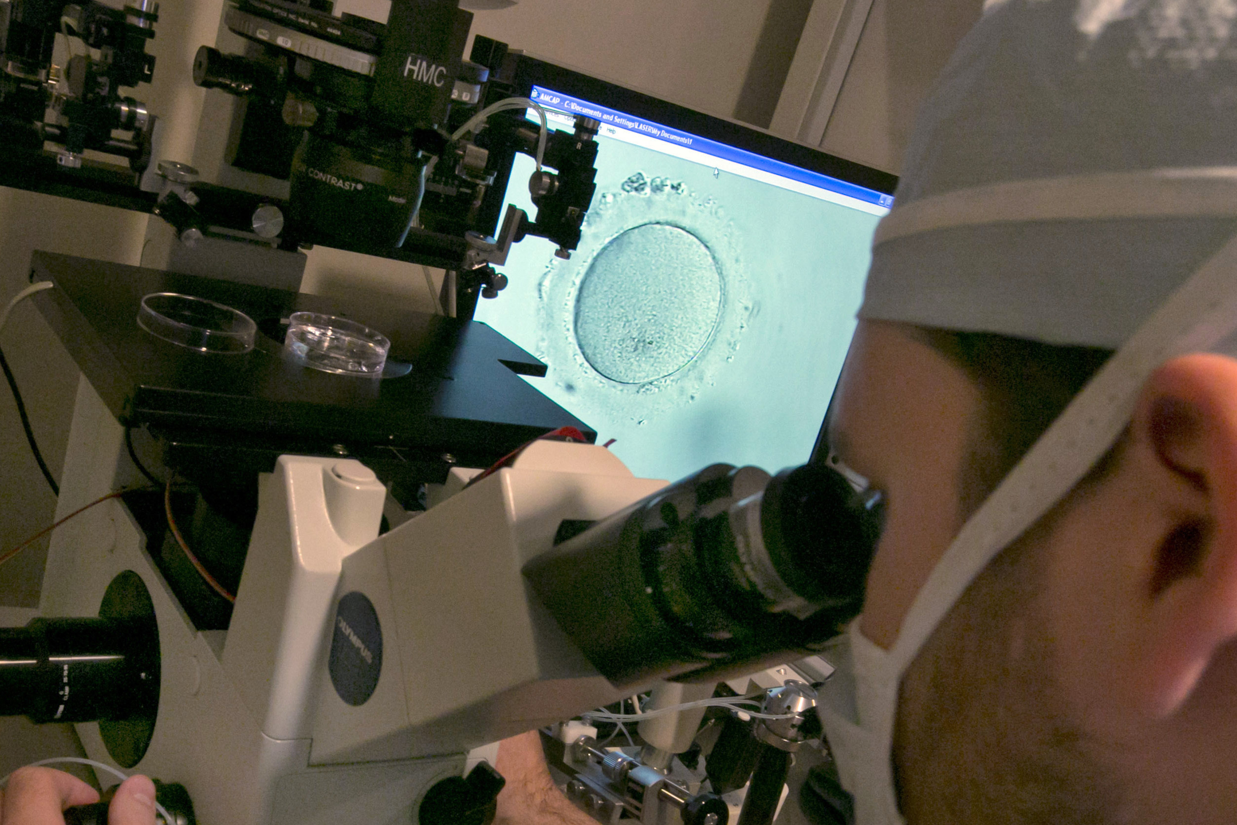 An embryologist uses a microscope to examine an embryo.
