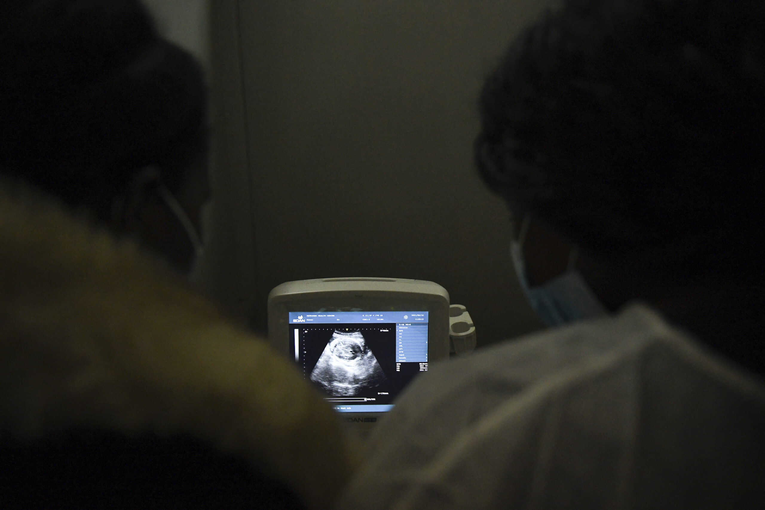 Nurses and midwives look at a sonogram