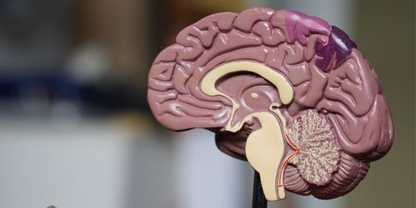 an image of a model brain