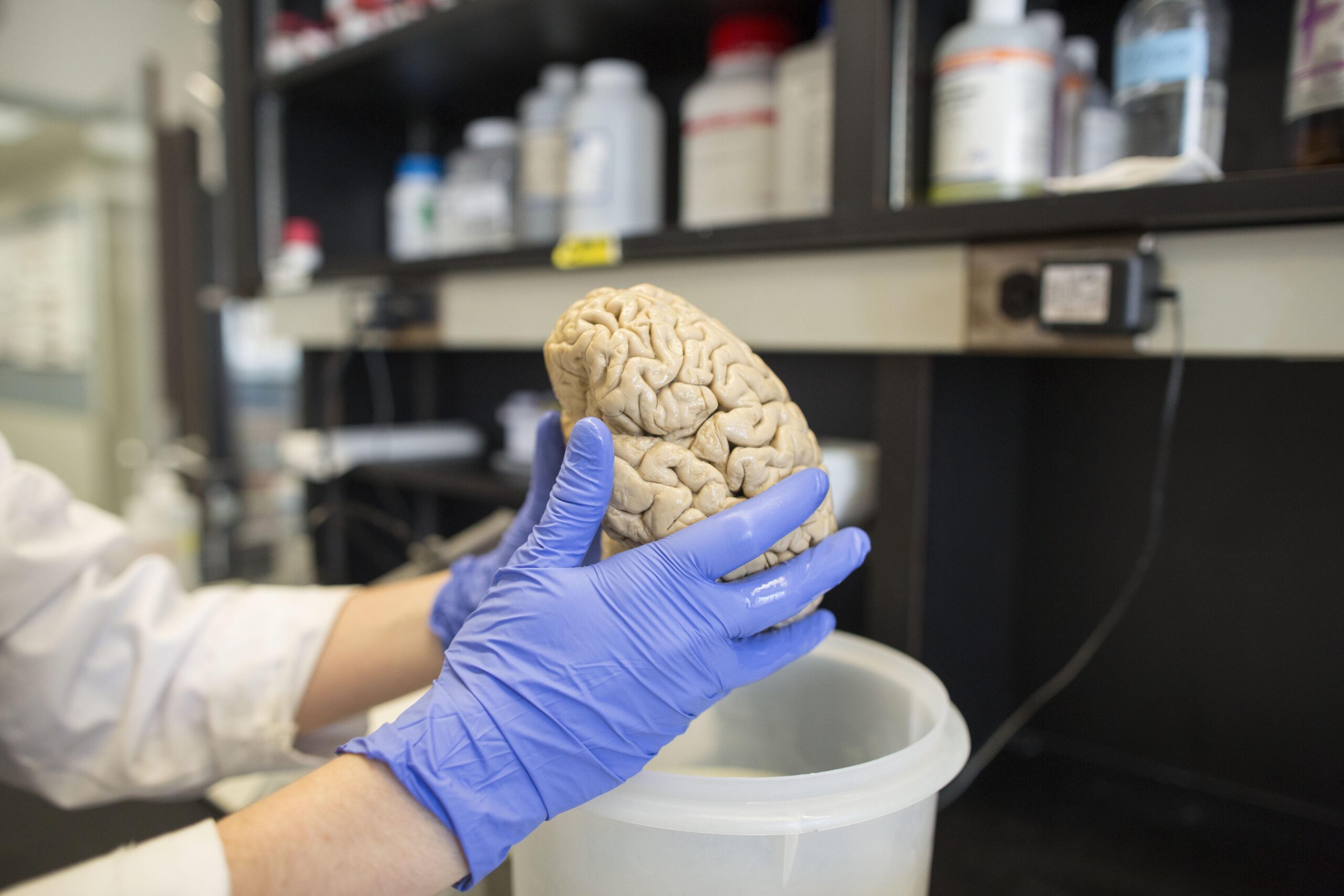In this July 29, 2013 photo, a researcher holds a human brain in a laboratory at Northwestern University's cognitive neurology and Alzheimer's disease center in Chicago.
