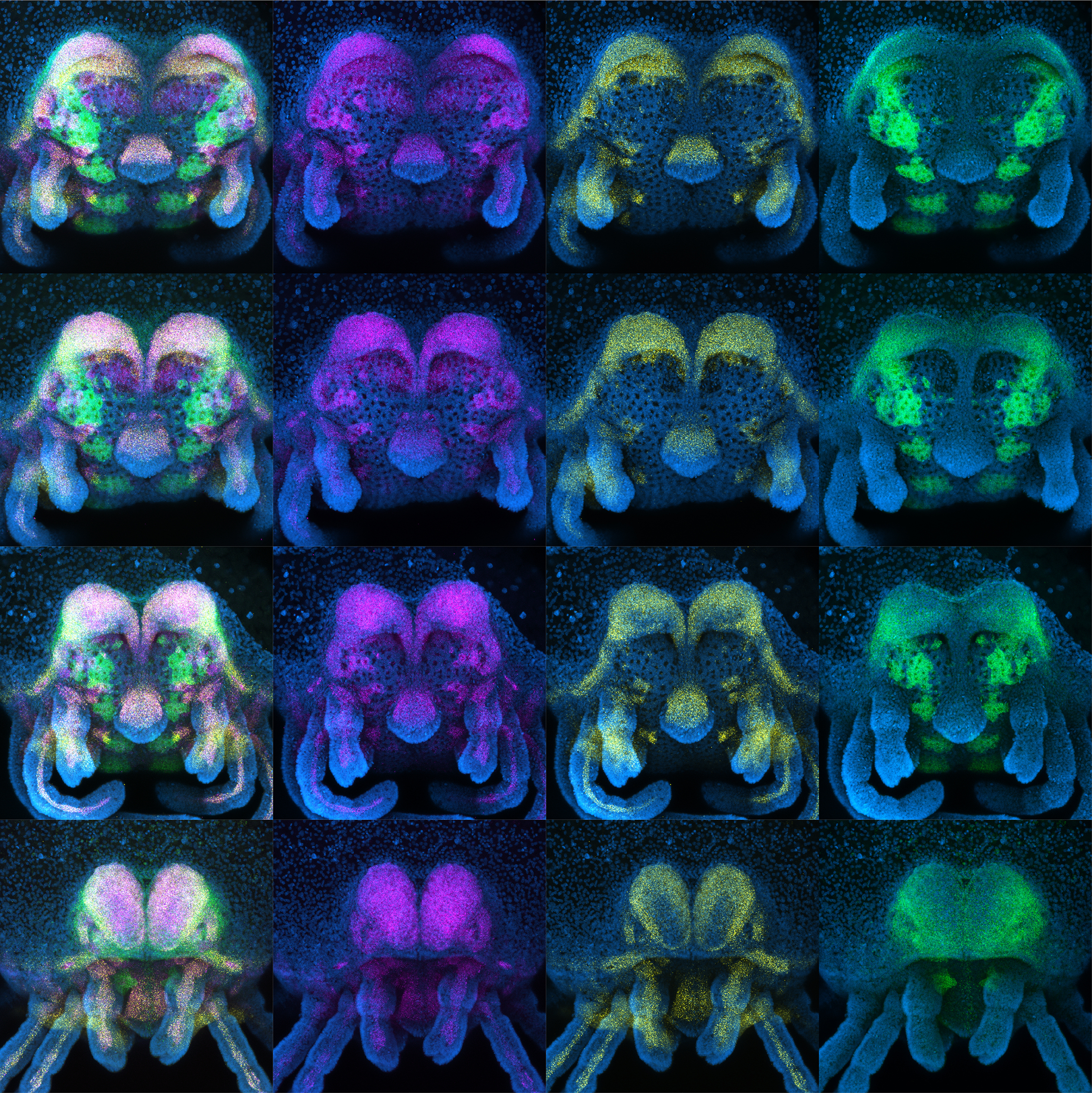 An image of heads of a single embryo at increasing developmental stages of eye formation. Magenta, yellow and green mark the expression of three different genes that code for vision. 