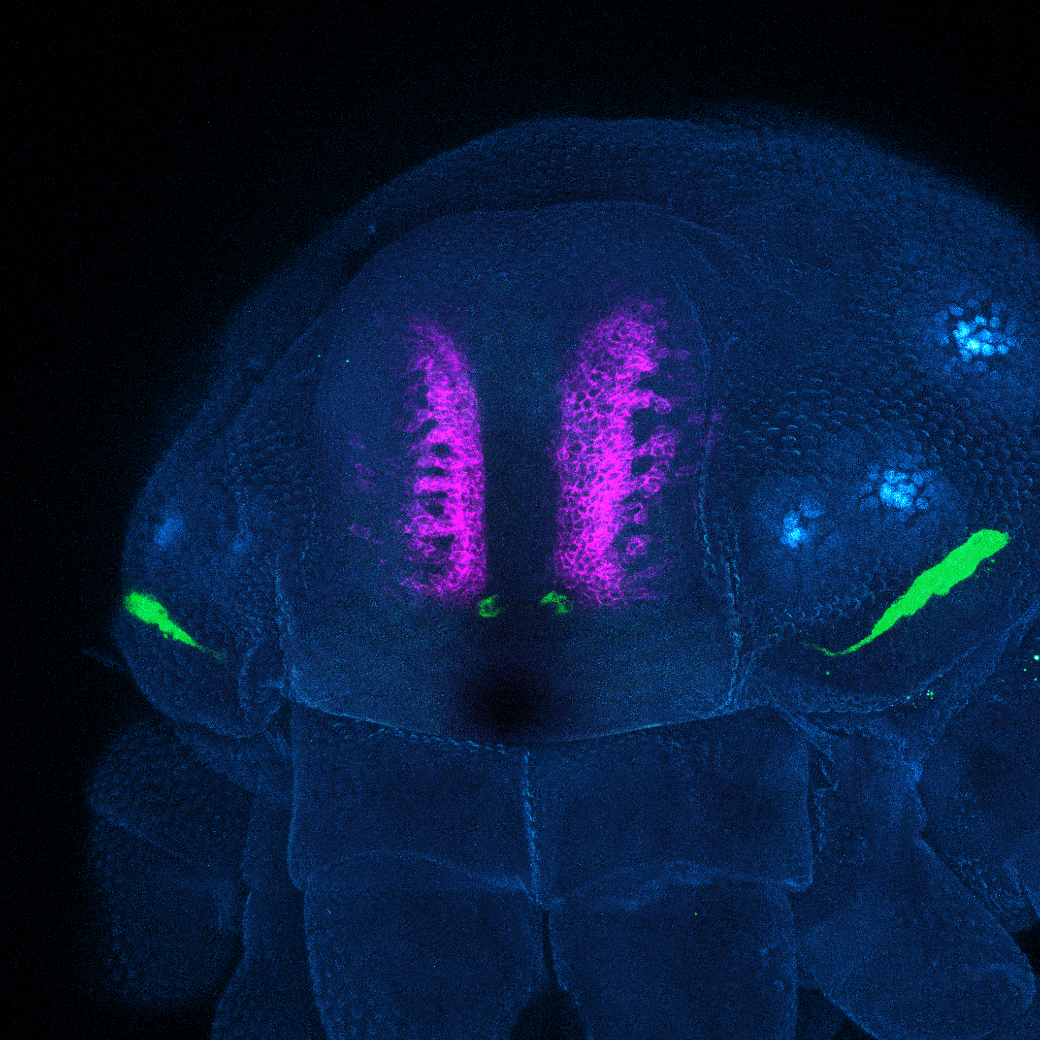 Under a microscope, the head of a daddy longlegs glows magenta where its modern-day eyes form.
