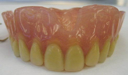 A set of upper dentures with artificial gums and teeth is shown resting on a white surface.