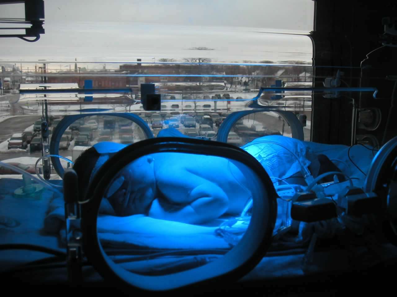 A newborn lies in an incubator under blue phototherapy lights, with medical equipment visible and a parking lot seen through the window in the background.